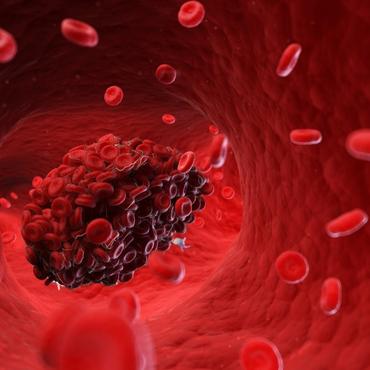 Vajinadan Ciğer Gibi Parça Gelmesi